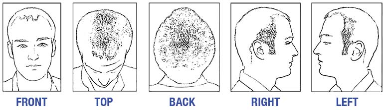 Hair Restoration for Men in Augusta, GA