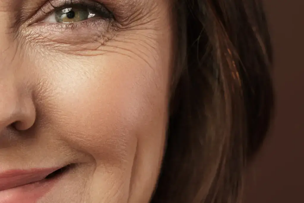 Cheeks, temples and jawline, areas Sculptra restores, in Augusta, GA
